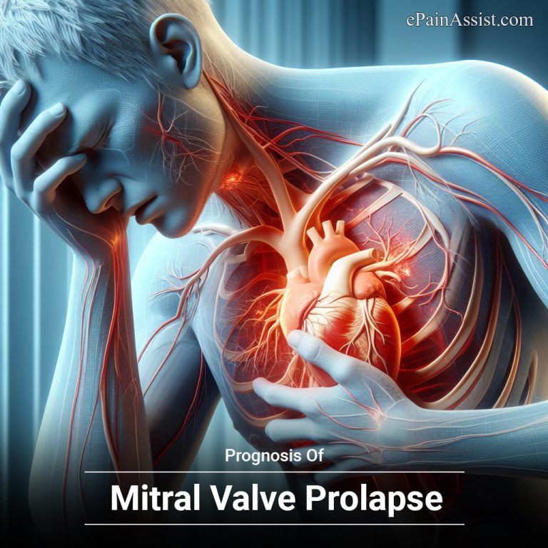 Prognosis Of Mitral Valve Prolapse
