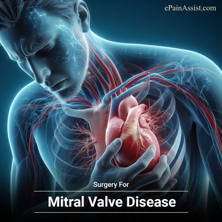 Surgery For Mitral Valve Disease
