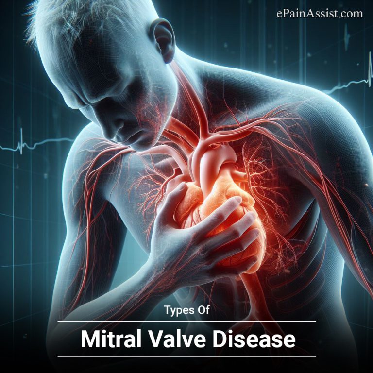 Types Of Mitral Valve Disease