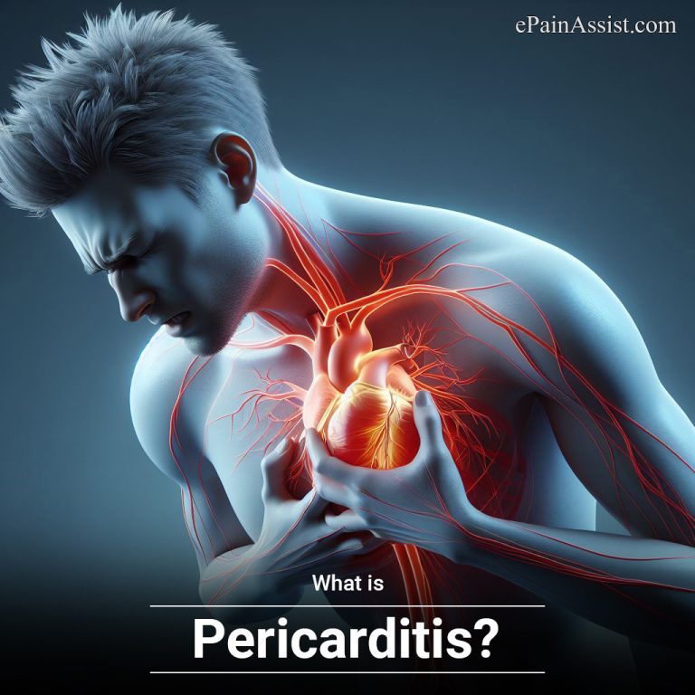 What is Pericarditis & How is it Treated?|Causes, Symptoms, Diagnosis of Pericarditis