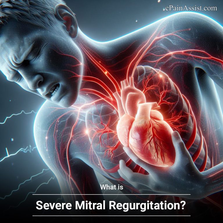 What Is Severe Mitral Regurgitation?