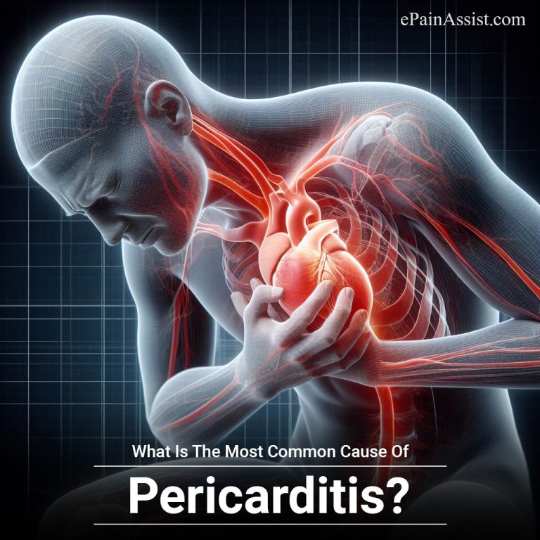 What Is The Most Common Cause Of Pericarditis?
