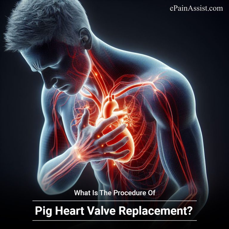 What Is The Procedure Of Pig Heart Valve Replacement?