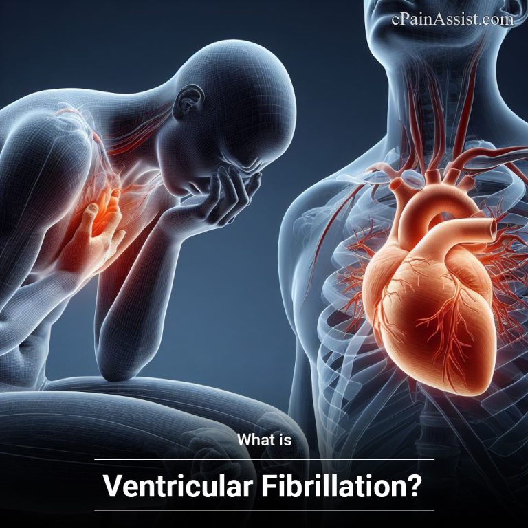 What is Ventricular Fibrillation: Causes, Symptoms, Treatment, Risk Factors, Diagnosis
