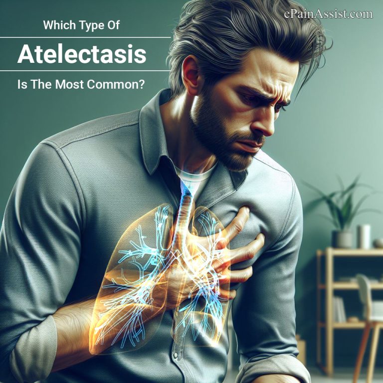 Which Type Of Atelectasis Is The Most Common?
