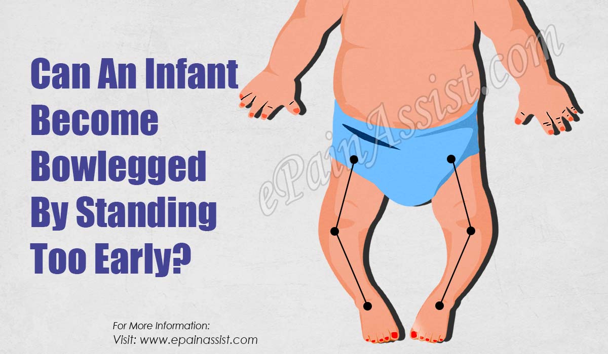 Can An Infant Become Bowlegged By Standing Too Early?