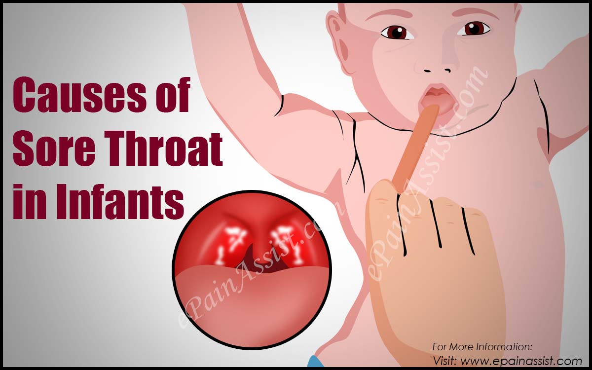 Causes of Sore Throat in Infants