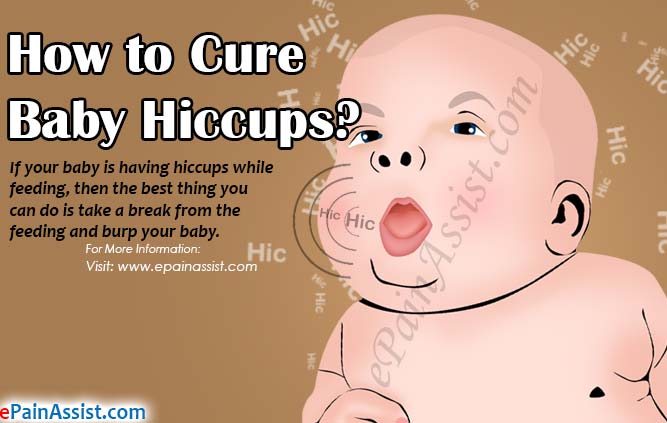 Stopping And Preventing Hiccups In Babies And Newborns