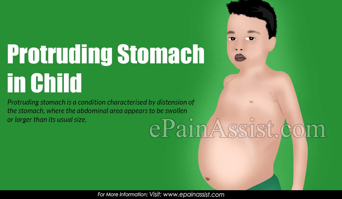 Protruding Stomach in Child