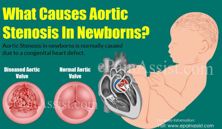 What Causes Aortic Stenosis In Newborns?