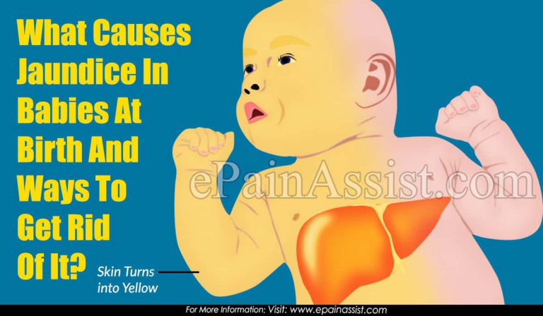 What Causes Jaundice In Babies At Birth And Ways To Get Rid Of It?