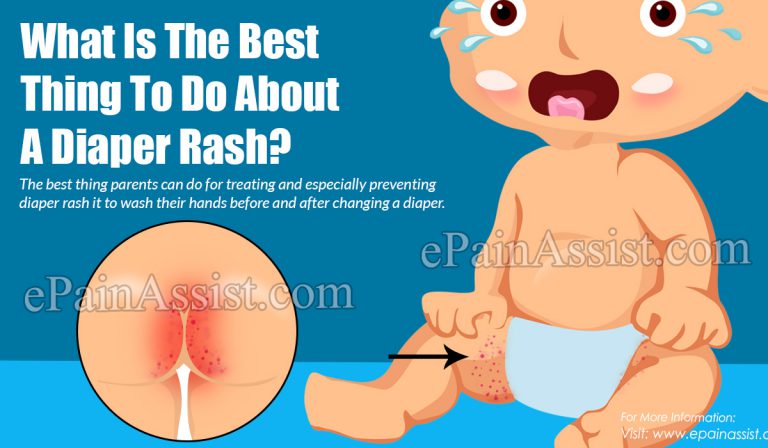 What Is The Best Thing To Do About A Diaper Rash? Its Treatment & Prevention