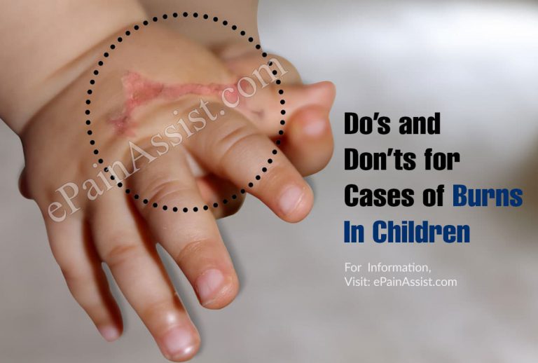 Do’s and Don’ts for Cases of Burns In Children