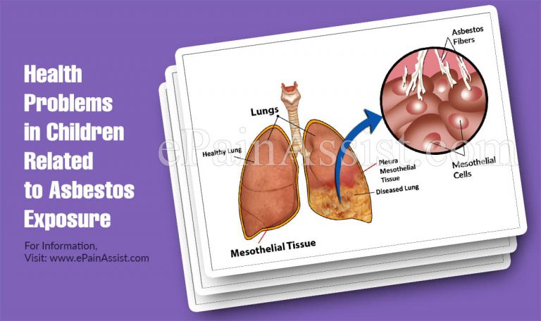 Health Problems in Children Related to Asbestos Exposure