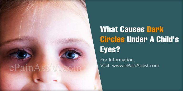 What Causes Dark Circles Under A Child’s Eyes?