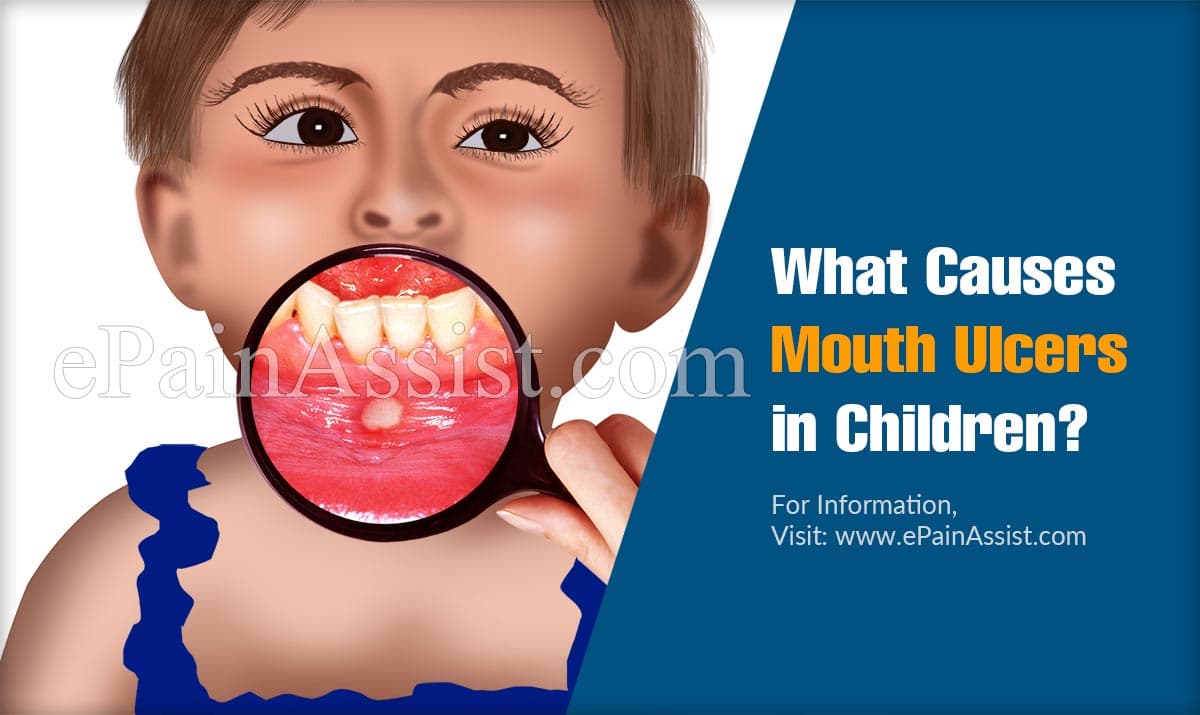 What Causes Mouth Ulcers in Children?