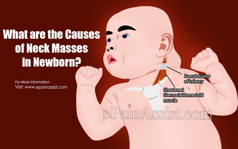 9 Causes Of Neck Masses In Newborn & Its Treatment, Diagnosis