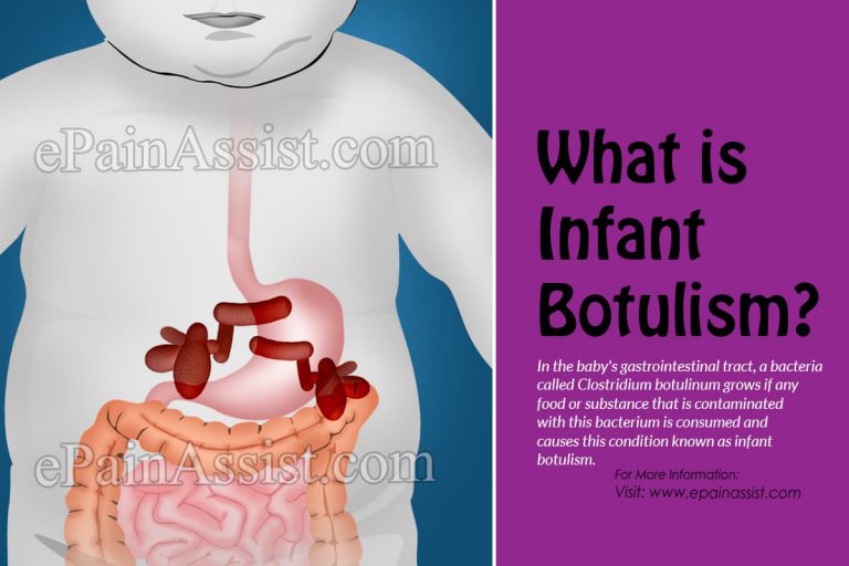 What is Infant Botulism & How is it Treated?| Causes, Symptoms, Prevention of Infant Botulism