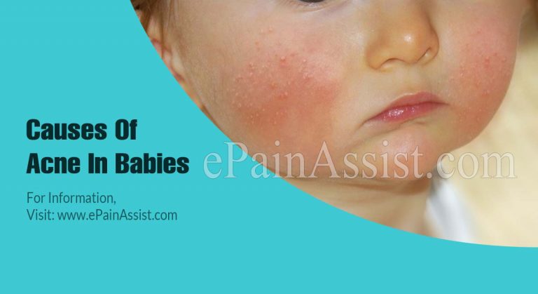 Causes Of Acne In Babies & How Long Does Baby Acne Last?