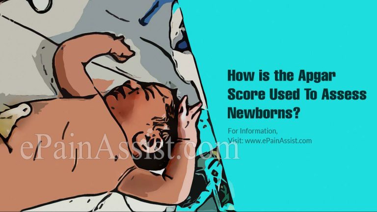 How is the Apgar Score Used To Assess Newborns?