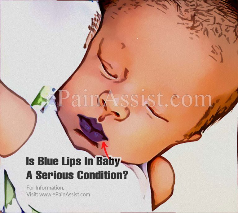 Is Blue Lips In Baby A Serious Condition?