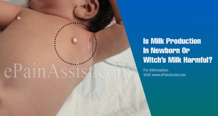 Milk Production In Newborns (Witch’s Milk)