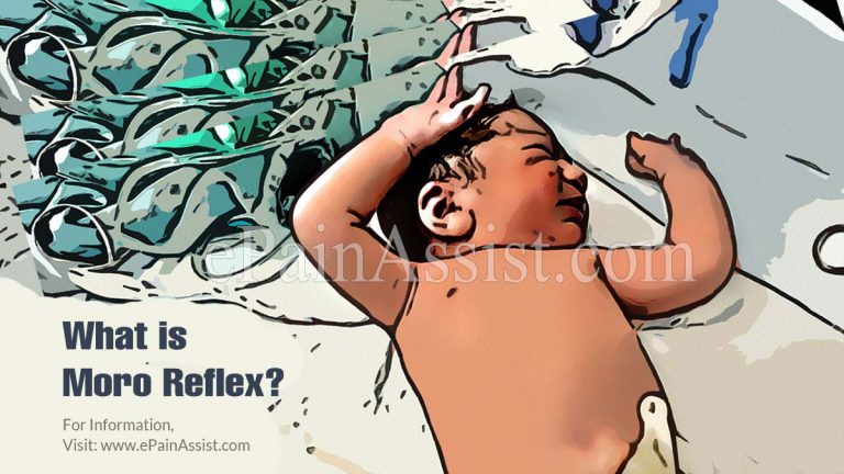 Moro Reflex: Triggers, Clinical Significance & Ways to Calm Moro Reflex