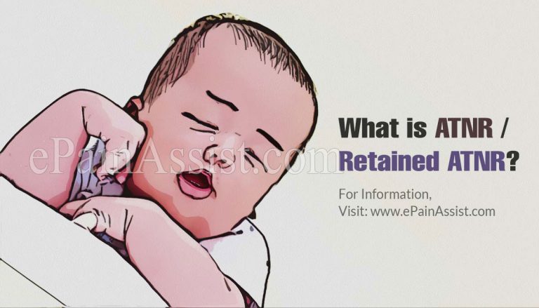 What is ATNR|Retained ATNR |Signs & Symptoms of Retained ATNR