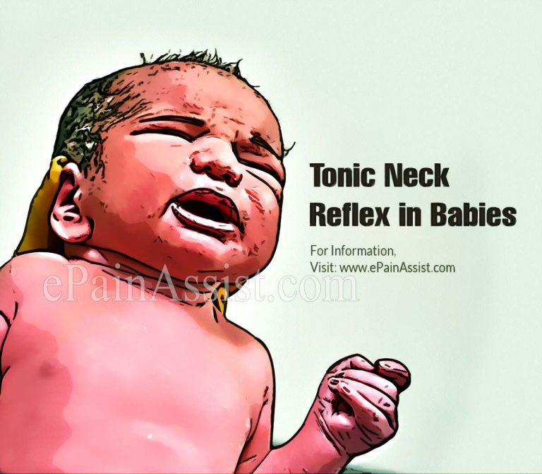 Tonic Neck Reflex in Babies
