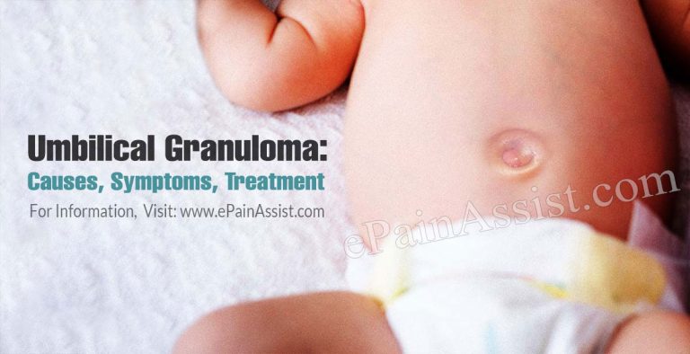 Umbilical Granuloma: Causes, Symptoms, Treatment