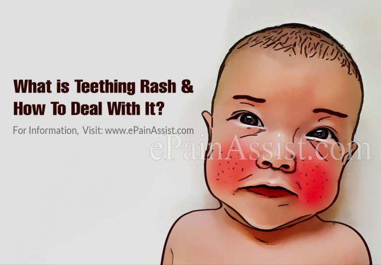 What is Teething Rash & How To Deal With It?