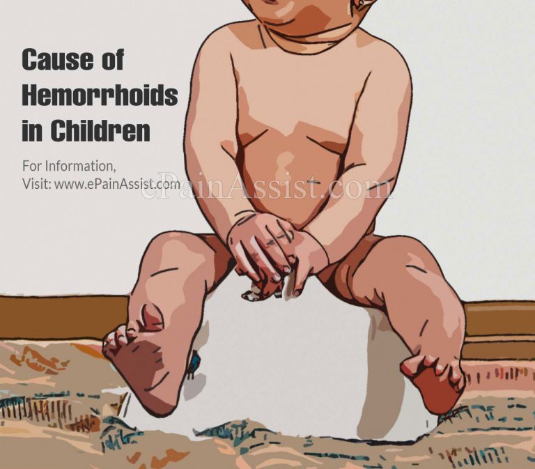 Causes of Hemorrhoids In Children & Its Symptoms, Treatment