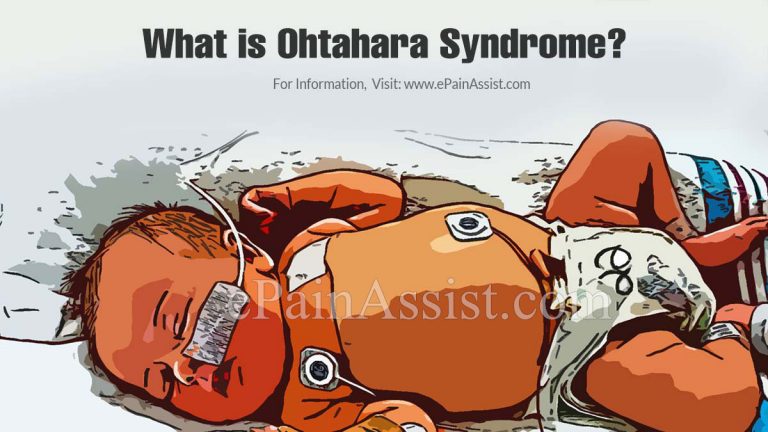 What is Ohtahara Syndrome & How is it Treated?|Causes, Symptoms, Prognosis of Ohtahara Syndrome