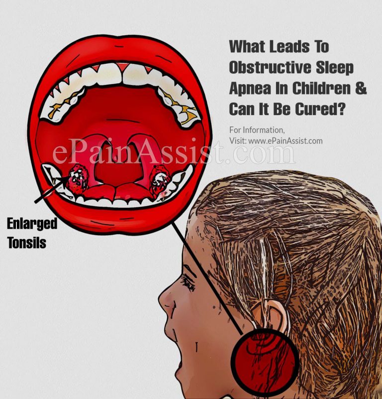 What Leads To Obstructive Sleep Apnea In Children & Can It Be Cured?