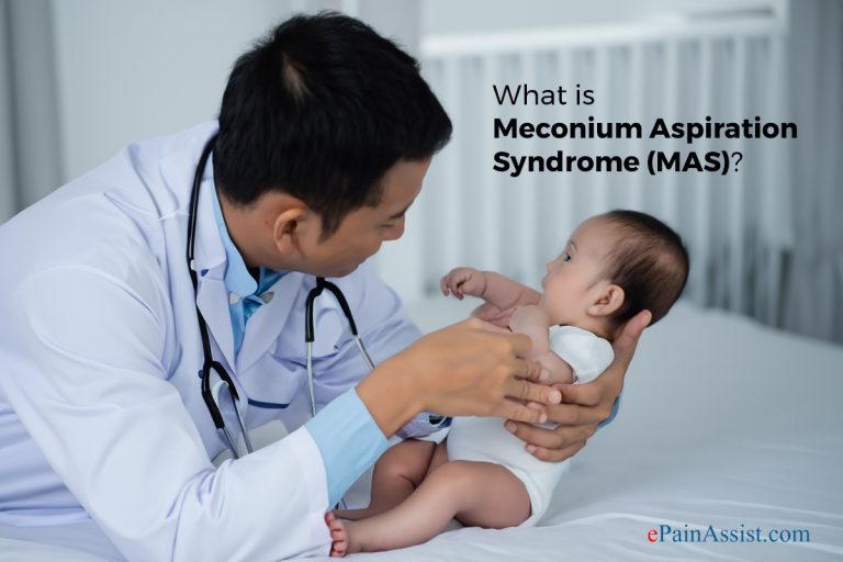 Meconium Aspiration Syndrome: Symptoms and Treatment