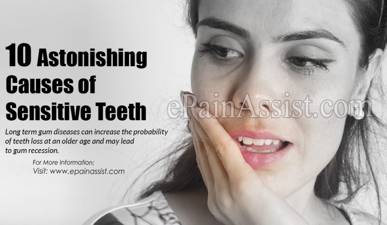 10 Astonishing Causes of Sensitive Teeth