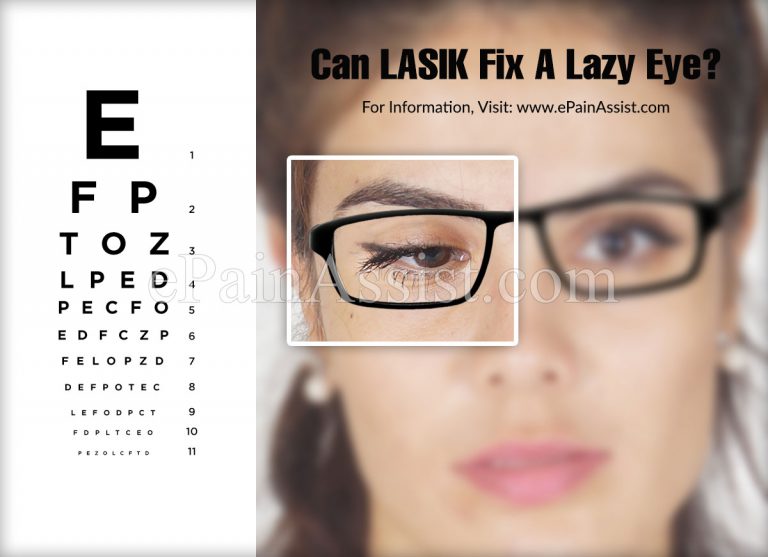 Can LASIK Fix A Lazy Eye?