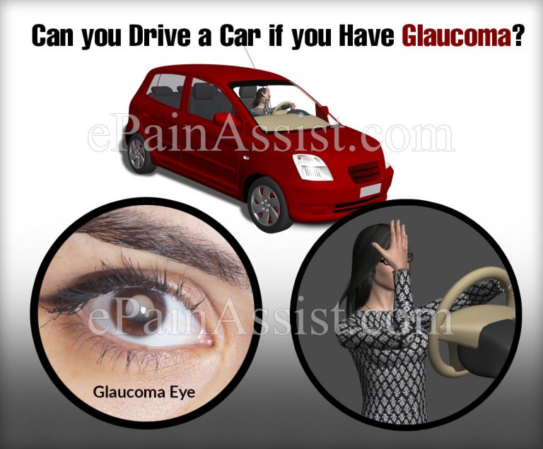 Can you Drive a Car if you Have Glaucoma?