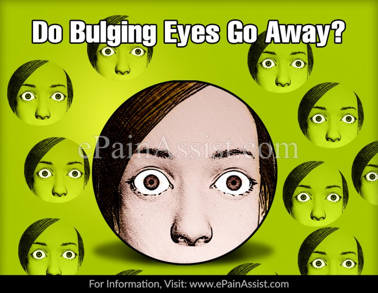 Do Bulging Eyes Go Away?