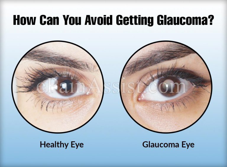 How Can You Avoid Getting Glaucoma?