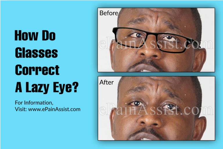 How Do Glasses Correct A Lazy Eye?