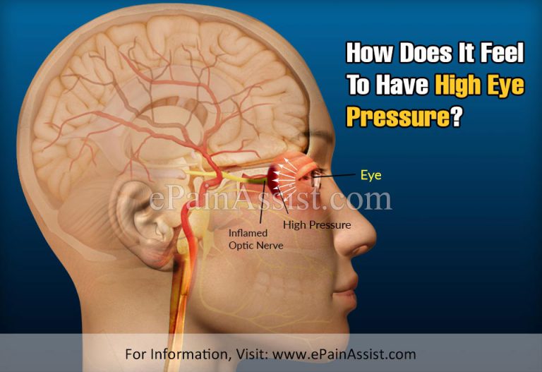 How Does It Feel To Have High Eye Pressure?