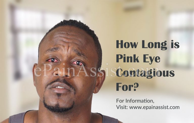 How Long is Pink Eye Contagious For?
