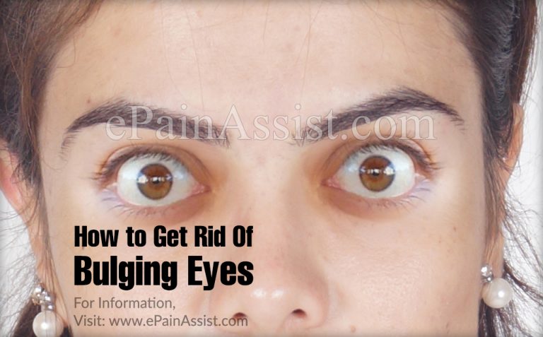 How to Get Rid Of Bulging Eyes?