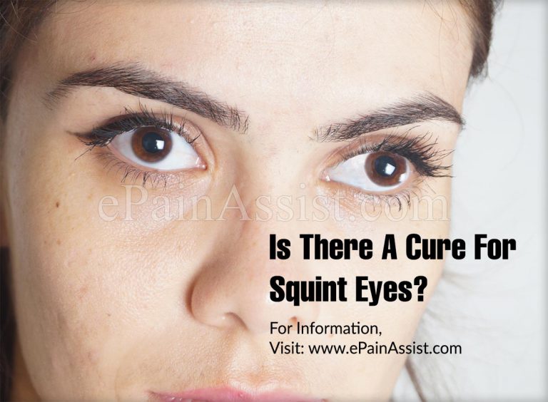 Is There A Cure For Squint Eyes?