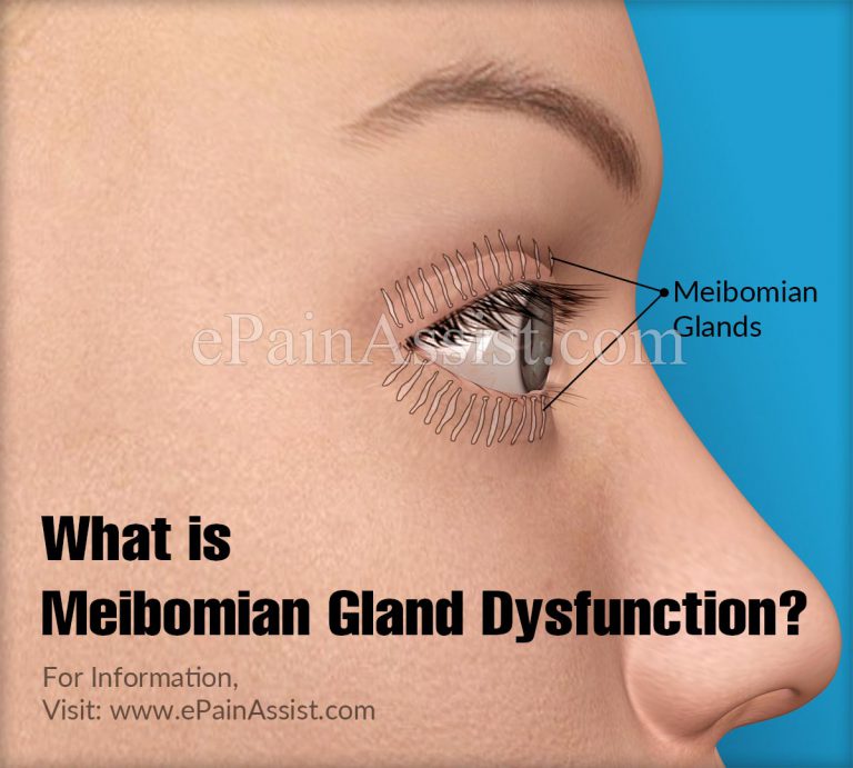 Meibomian Gland Dysfunction : Causes, Symptoms, Treatment, Home Remedies