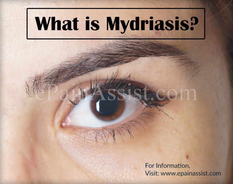 Mydriasis : Causes, Symptoms, Treatment, Diagnosis, Prevention