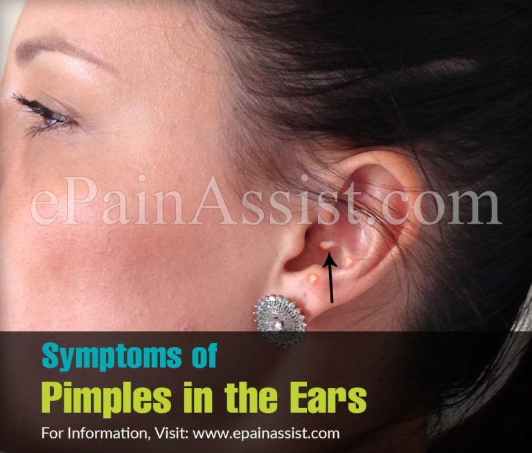 Pimple in Ear : Symptoms, Causes, Treatment, Medications