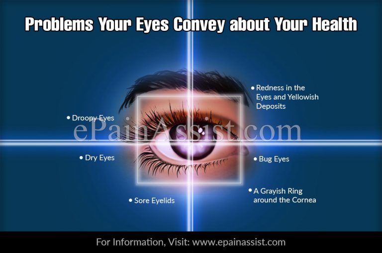 6 Problems Your Eyes Convey about Your Health