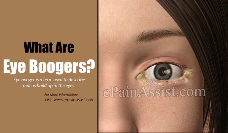 What are Eye Boogers & How to Get Rid of It?